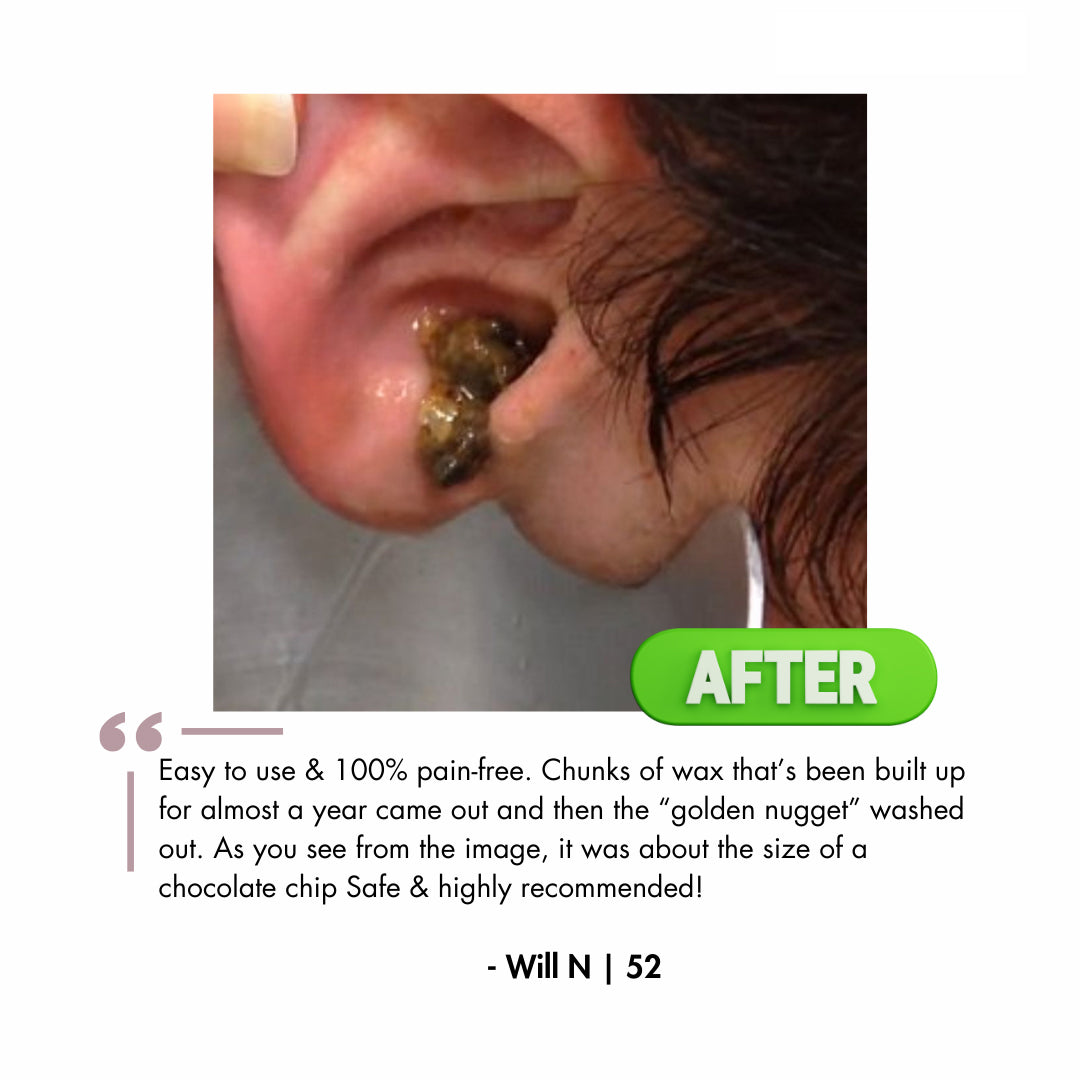 Official Genuine FDA-Certified KAUGIC Smart Water-Powered Ear Wax Cleaner