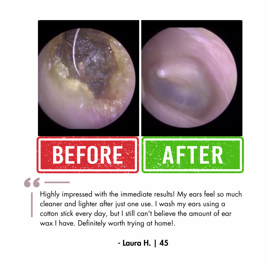 Official Genuine FDA-Certified KAUGIC Smart Water-Powered Ear Wax Cleaner
