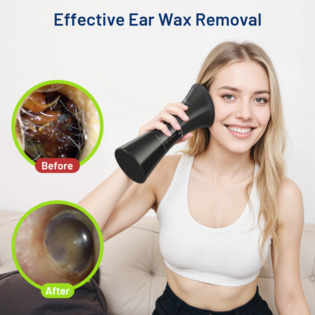 How to Clean Earwax at Home Safely Using the KAUGIC Ear Irrigation Kit