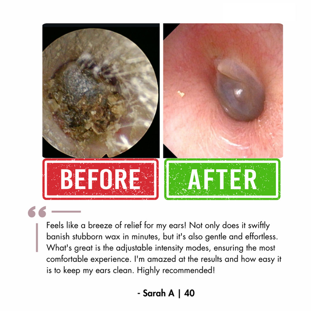 Official Genuine FDA-Certified KAUGIC Smart Water-Powered Ear Wax Cleaner