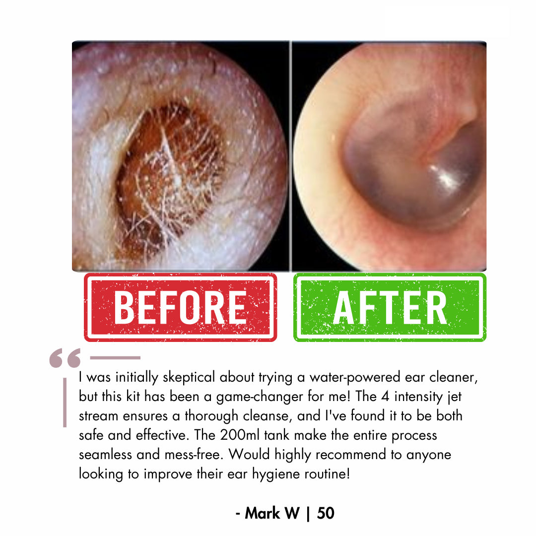 Official Genuine FDA-Certified KAUGIC Smart Water-Powered Ear Wax Cleaner